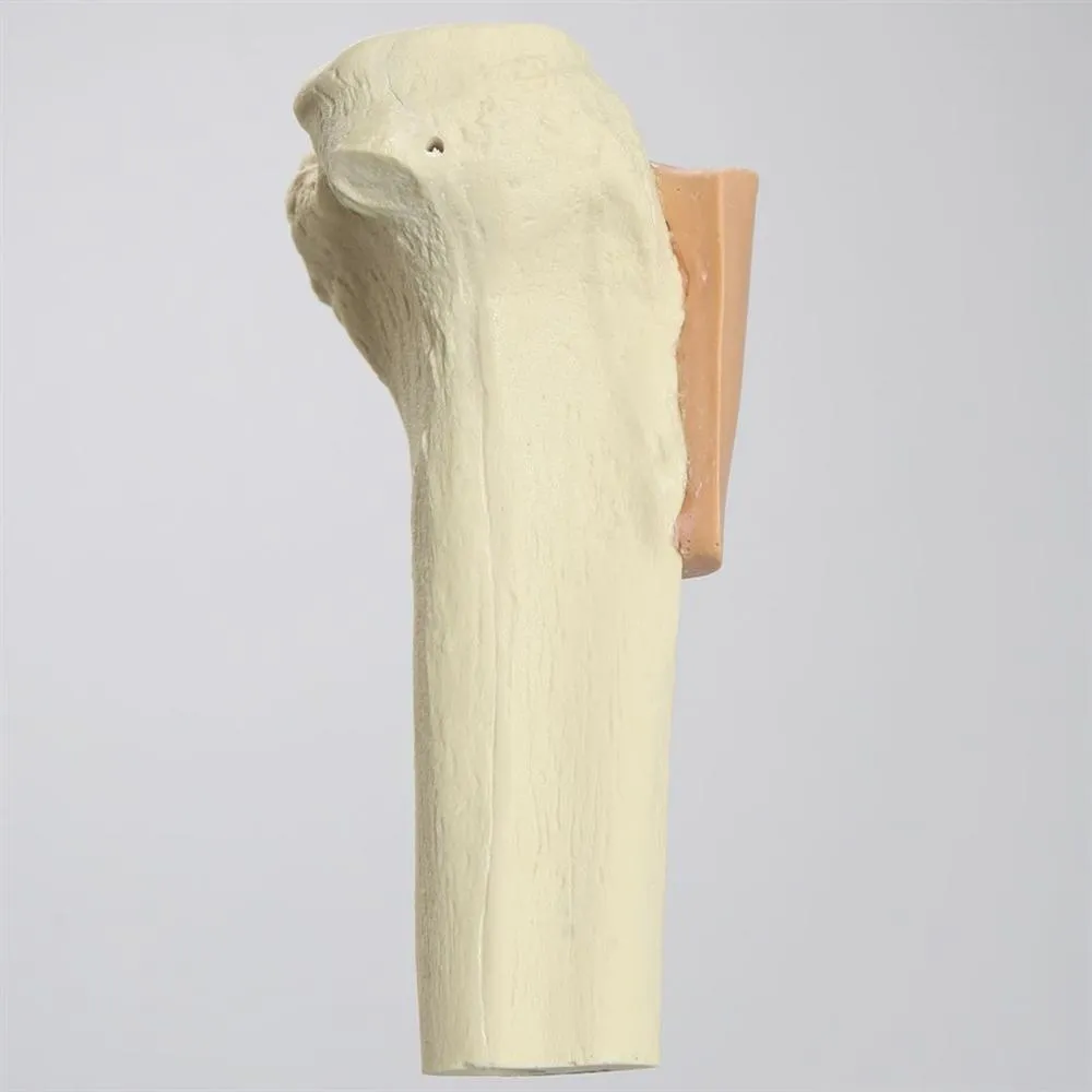 Proximal Tibia with Skin Patch for SB151713