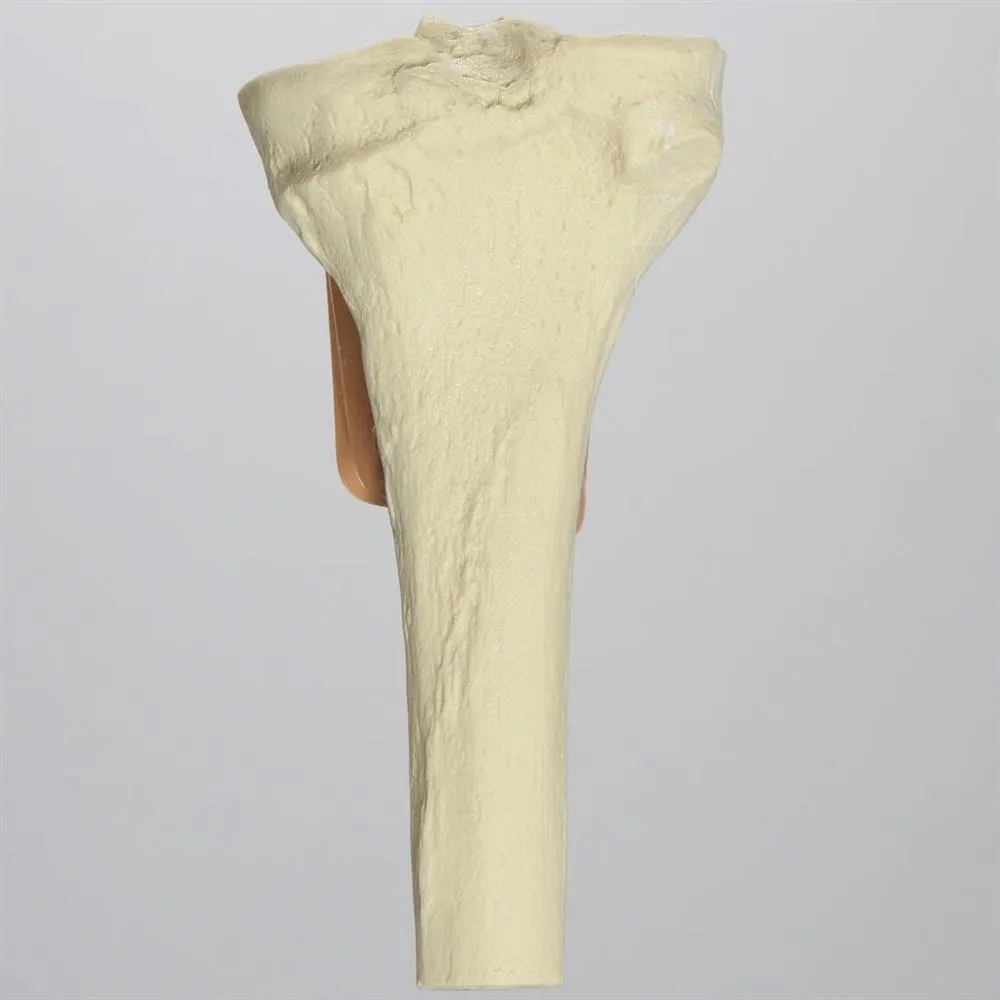 Proximal Tibia with Skin Patch for SB151713