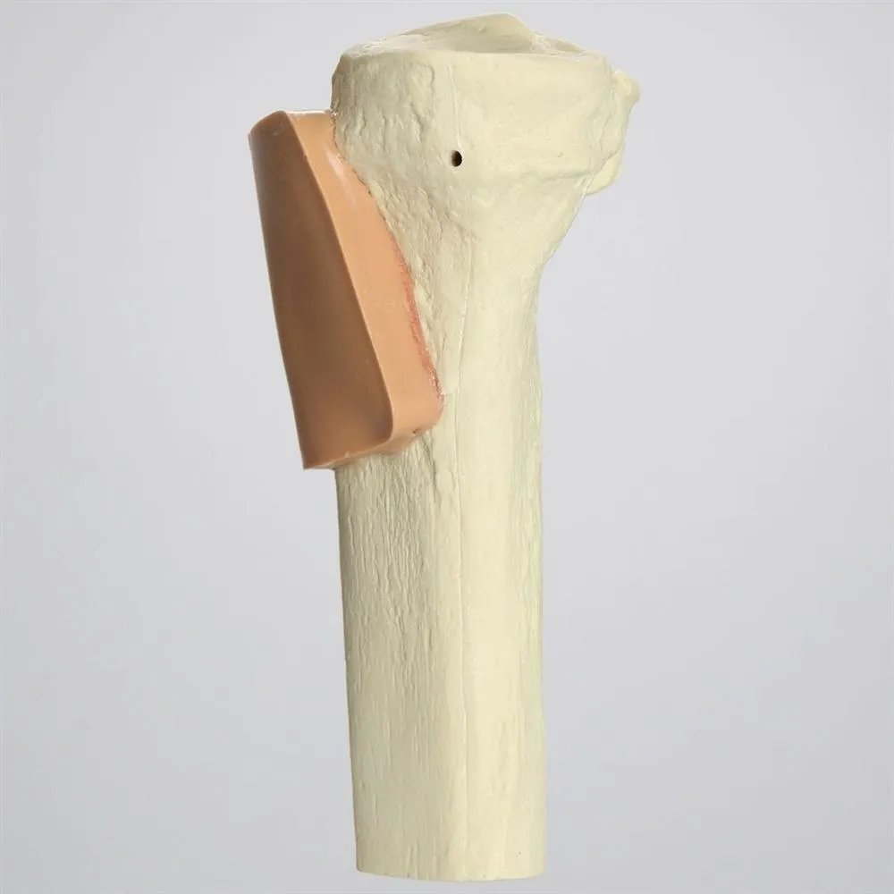 Proximal Tibia with Skin Patch for SB151713